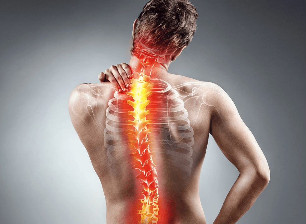 Upper-back-pain